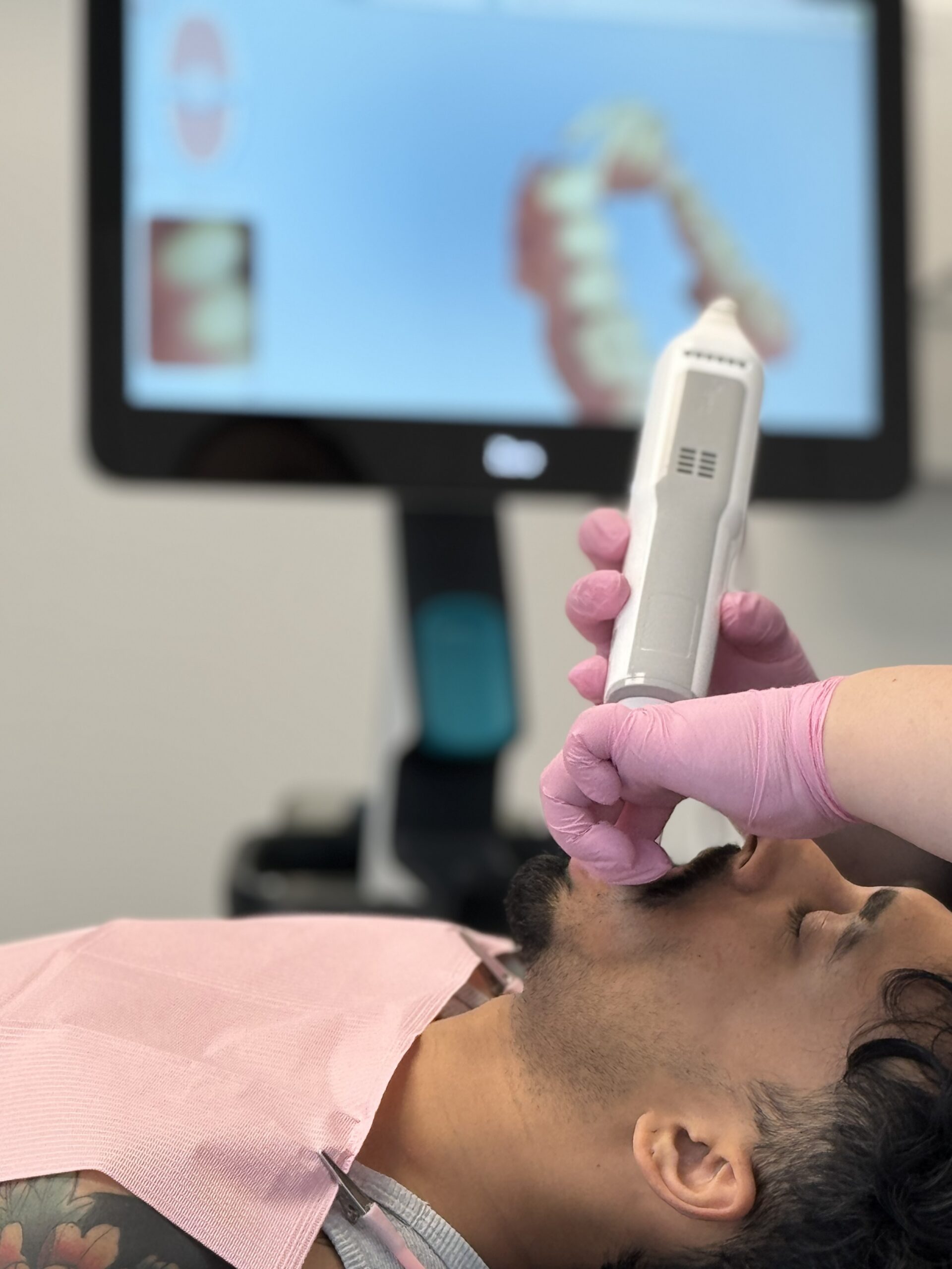 Plaque occlusale pour bruxeurs à Laval — Smile Boutik